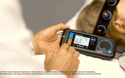 Innovative new technology detects and monitors non-convulsive seizures